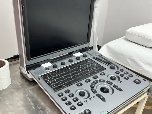 Ultrasonografický prístroj pripravený na vyšetrenie priamo v centre